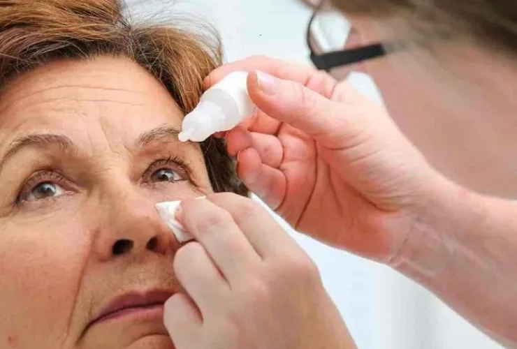 Brasil vive surto de herpes zoster