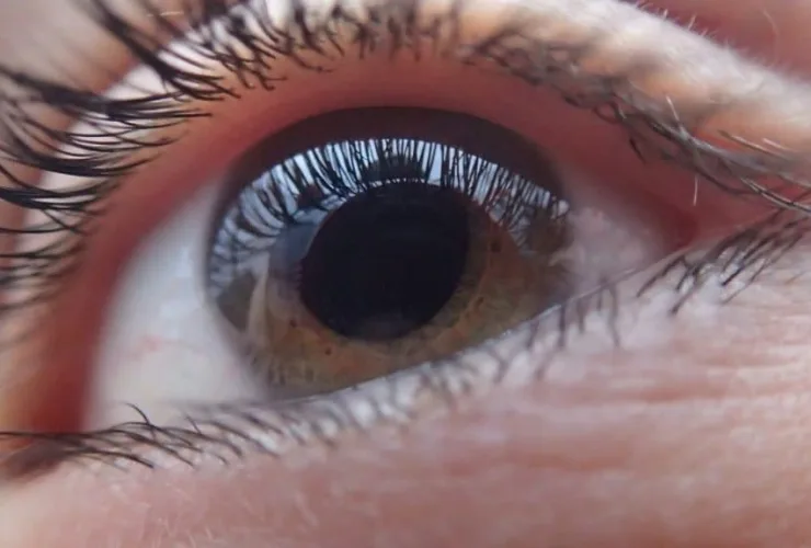Principal causa de cegueira irreversível no mundo, Glaucoma atinge 80 milhões de pessoas, segundo OMS