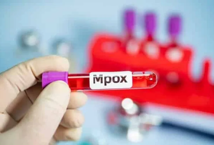 Mpox: entenda o que mudou do surto de 2022 para o atual