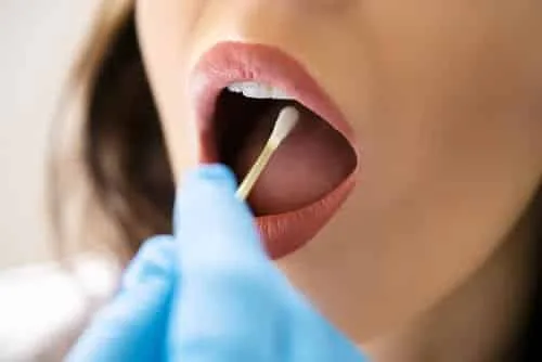 Subespécie de bactéria da boca pode estar associada ao câncer colorretal