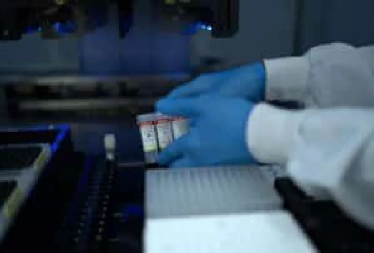 Brasil incorpora teste molecular para HPV que reduziu casos de câncer de útero em Portugal