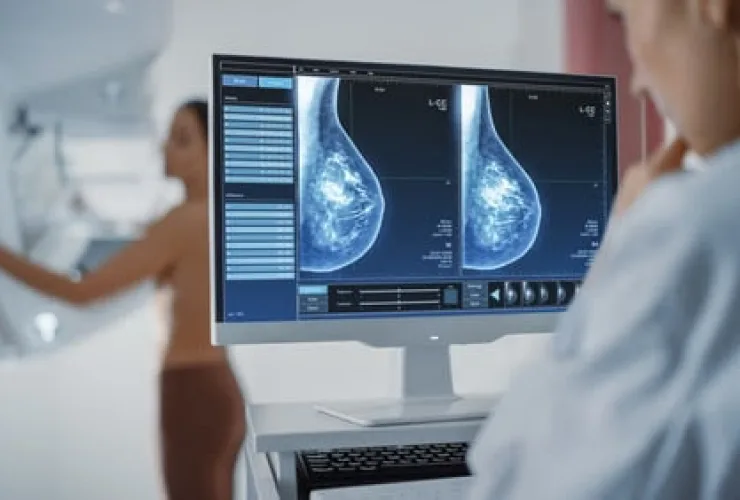 A partir de quando a mamografia deve ser anual?  Estudo reforça: após os 40 anos