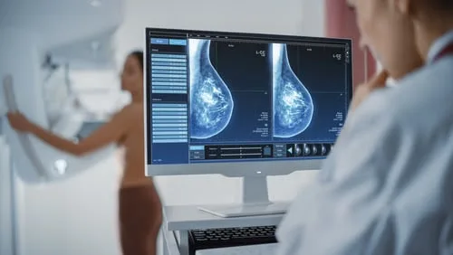 A partir de quando a mamografia deve ser anual?  Estudo reforça: após os 40 anos