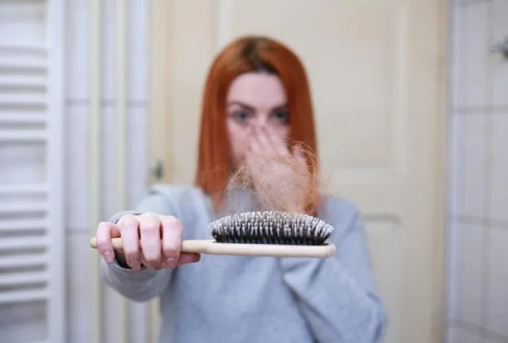 Com impacto emocional, alopecia areata 
ganha novas opções de tratamento