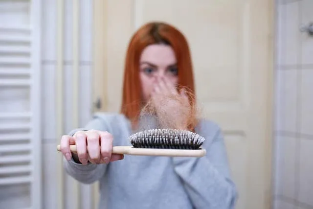 Com impacto emocional, alopecia areata 
ganha novas opções de tratamento