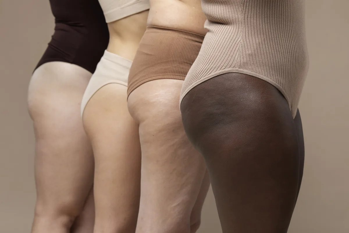 Detox terapêutico pode ser aliado no controle do lipedema, aponta nutricionista