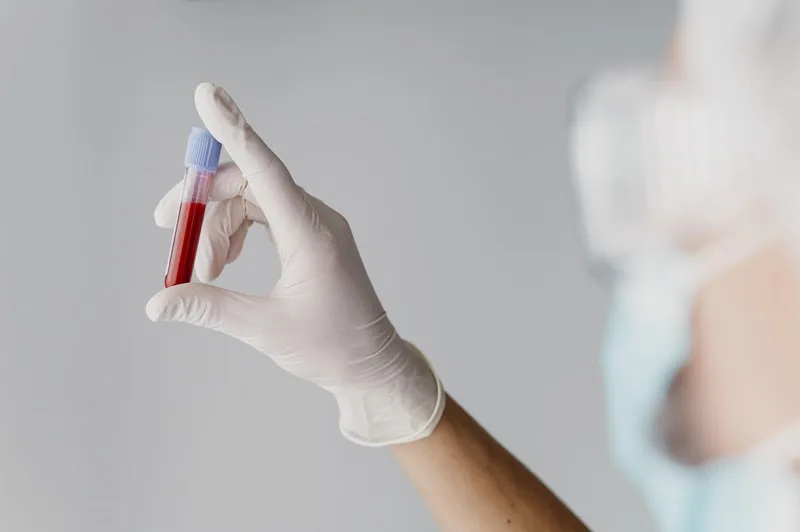 Sangue tem prazo de validade? Descubra por que é tão importante doar com regularidade