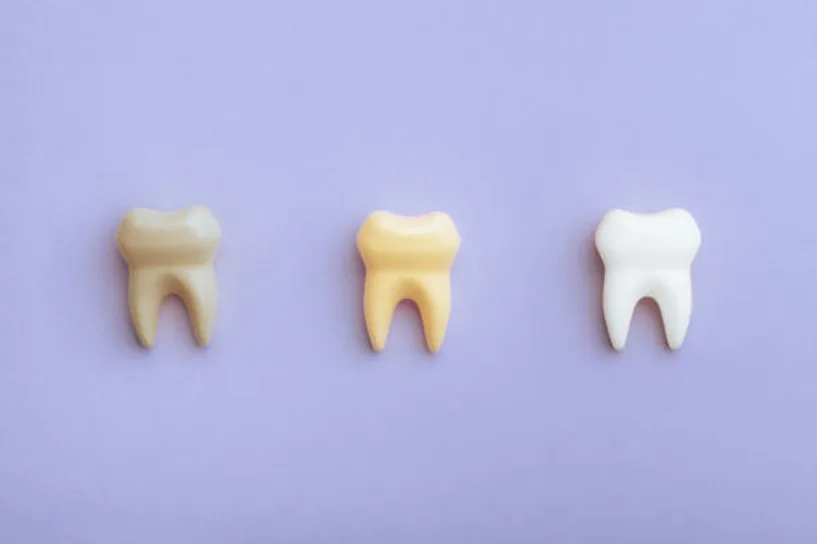 Mitos e verdades sobre alimentos que mancham os dentes