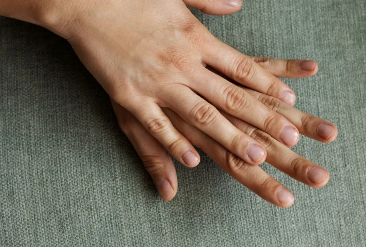 Unhas: dermatologista explica o que elas querem dizer sobre a saúde