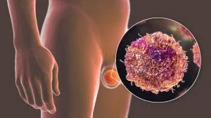 Mais de 60% das mortes por câncer de testículo no Brasil ocorrem entre homens de 20 a 39 anos