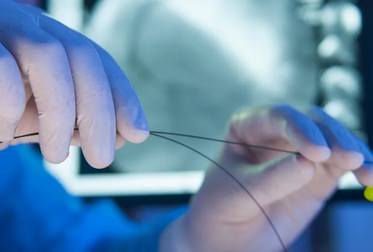 Mãos com luvas cirúrgicas seguram um fio-guia fino durante um procedimento, com monitores ao fundo